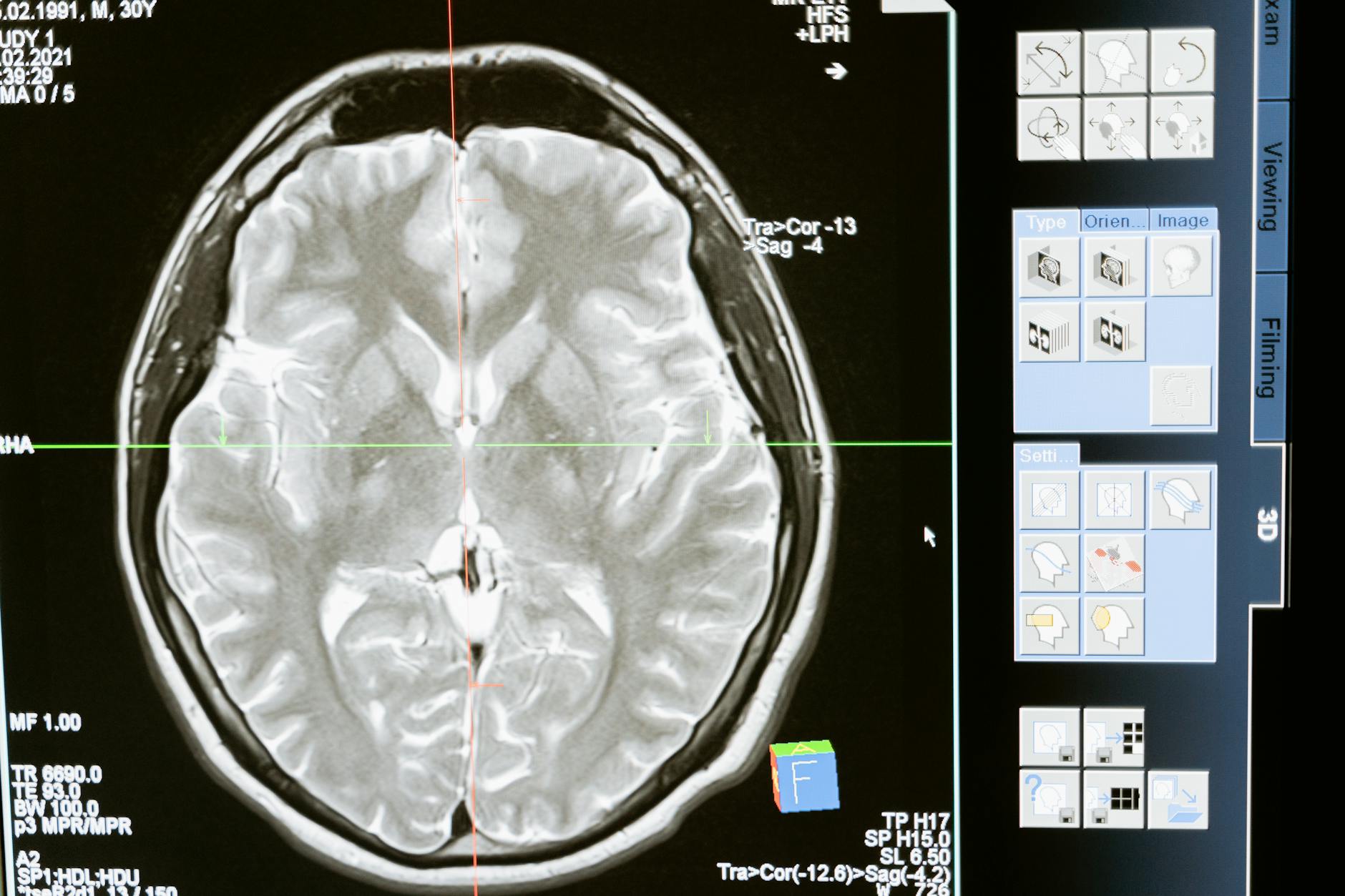 The Left Brain / Right Brain Split Is a Great Story. It's Also Mostly Fiction.